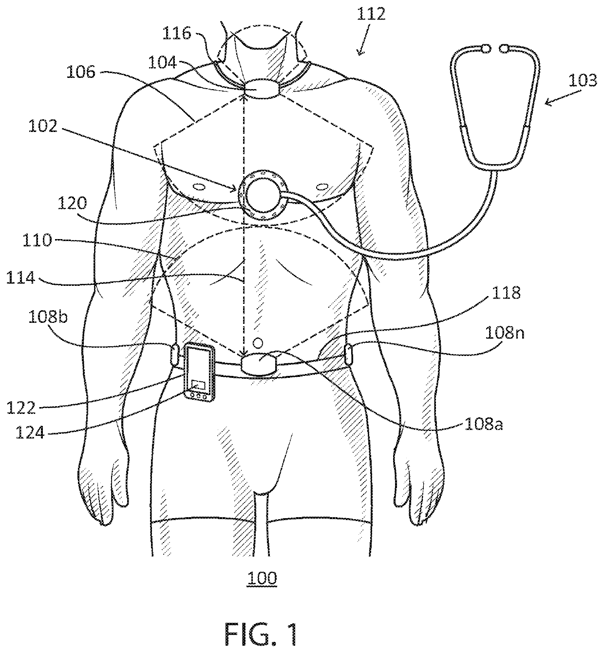 Medical attachment device tracking system and method of use thereof