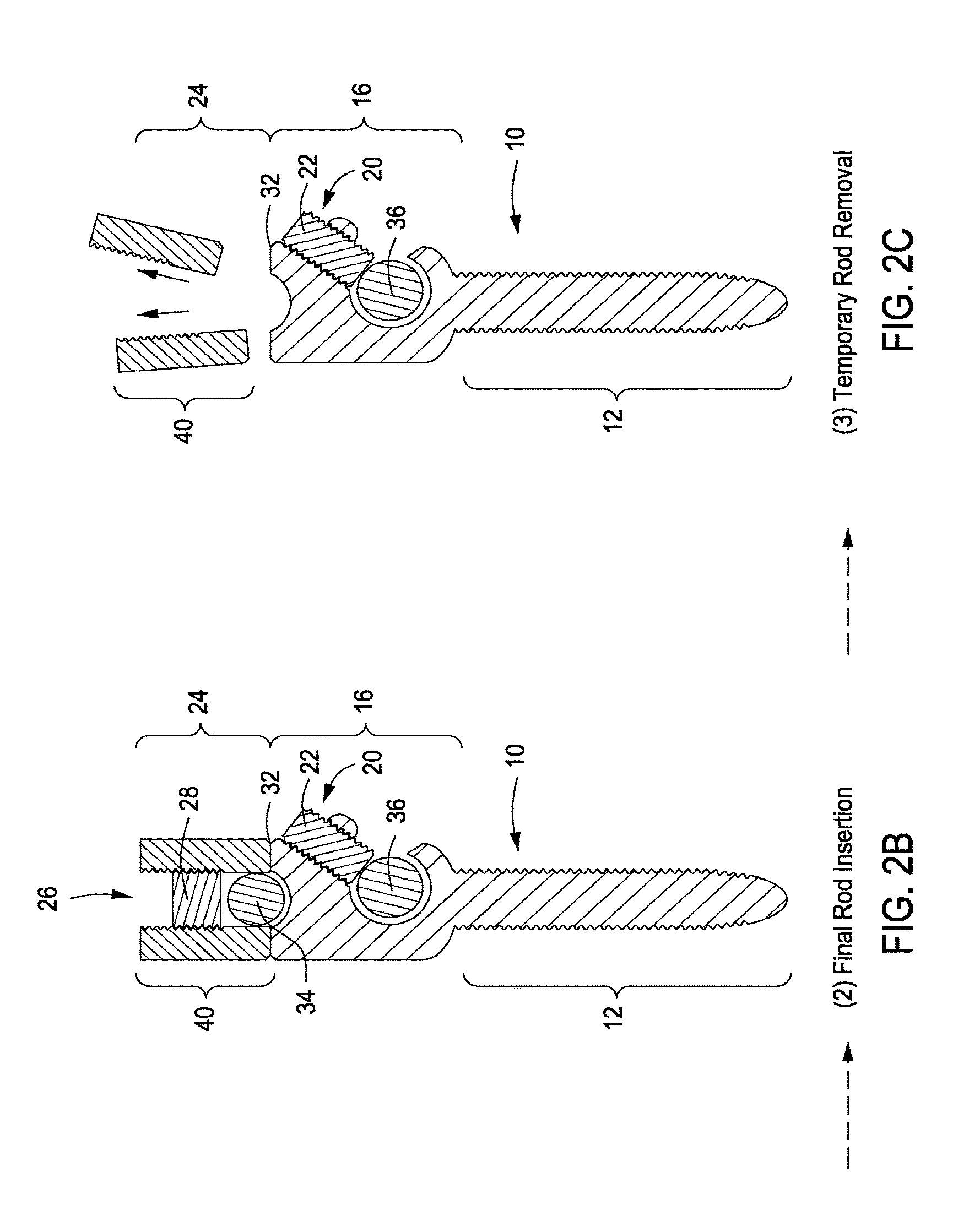 Spinal rod link reducer