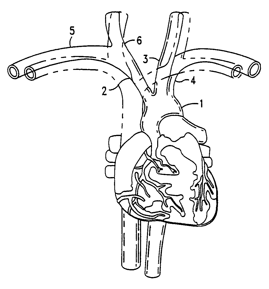 Method for noninvasive continuous determination of physiologic characteristics