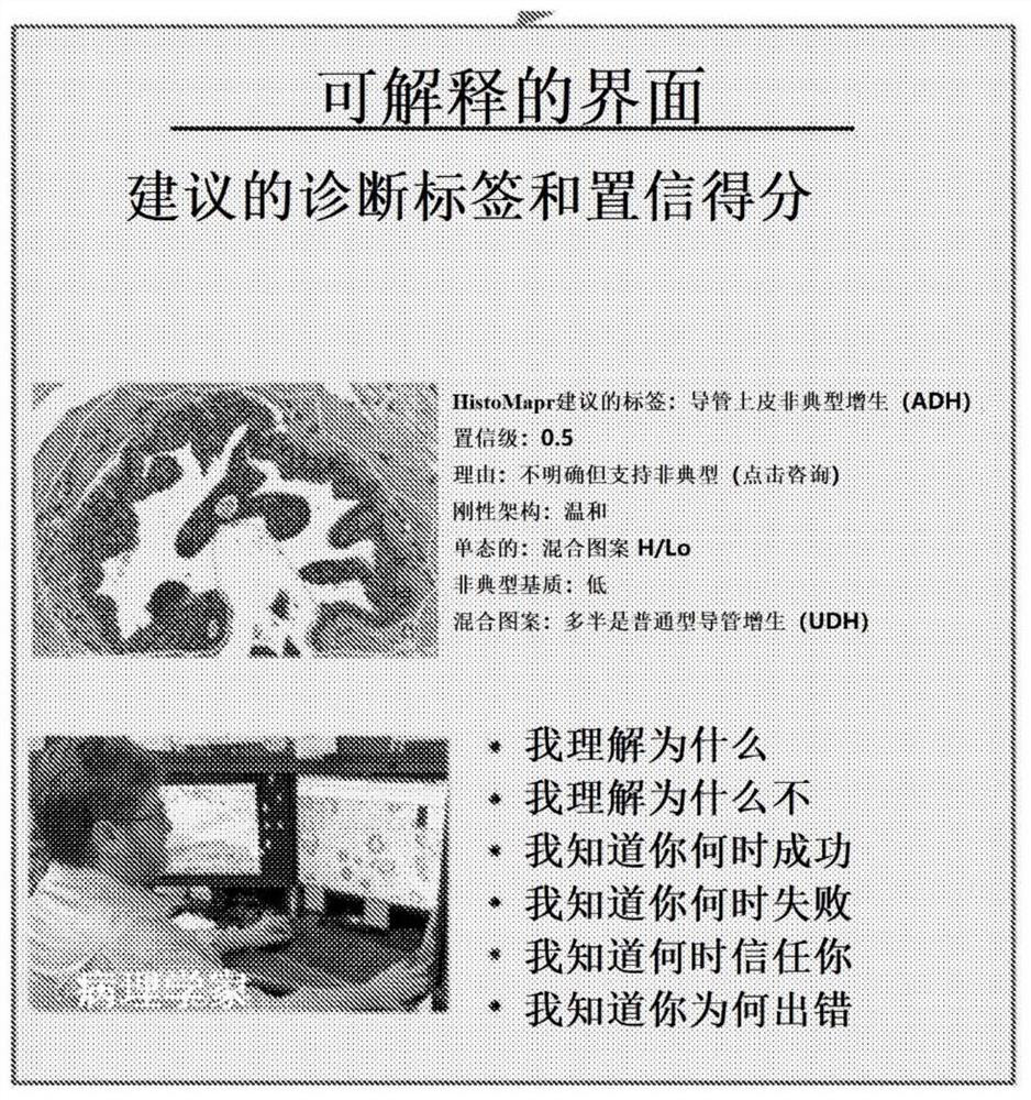 Explainable ai (XAI) platform for computational pathology