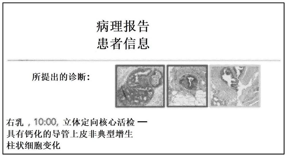 Explainable ai (XAI) platform for computational pathology