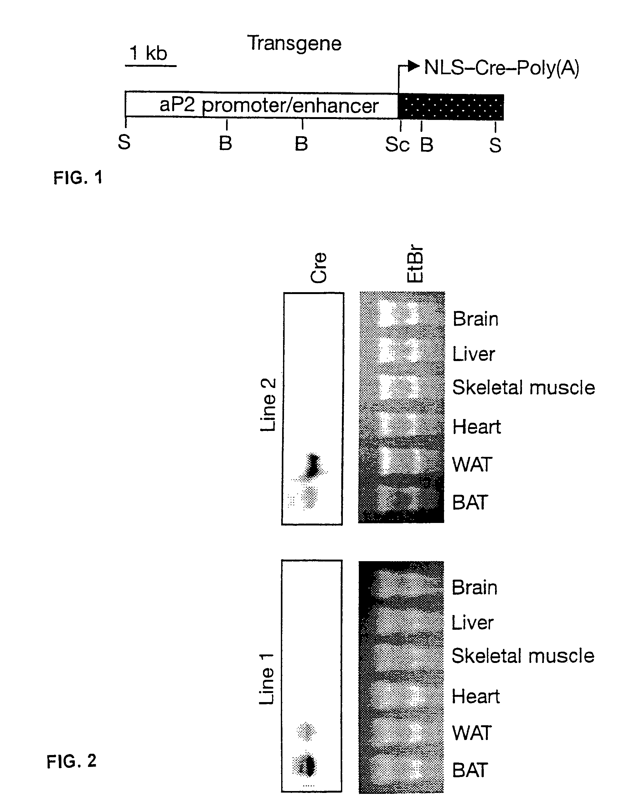 RBP4 in insulin sensitivity/resistance, diabetes, and obesity