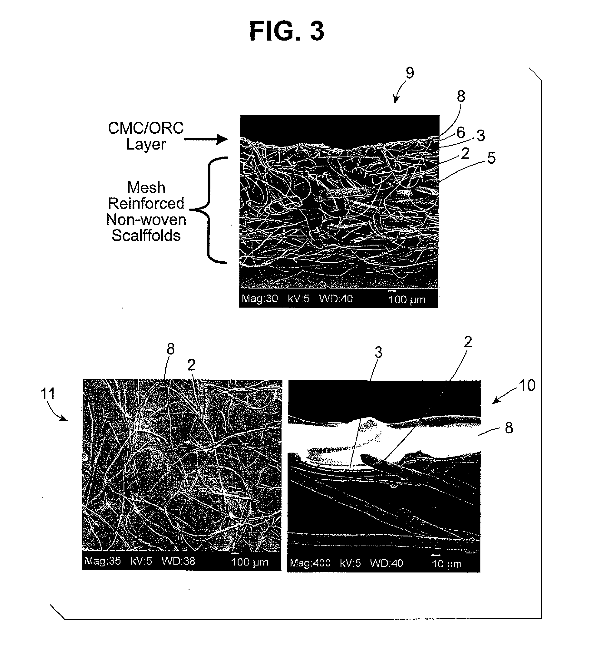 Coated Tissue Engineering Scaffold