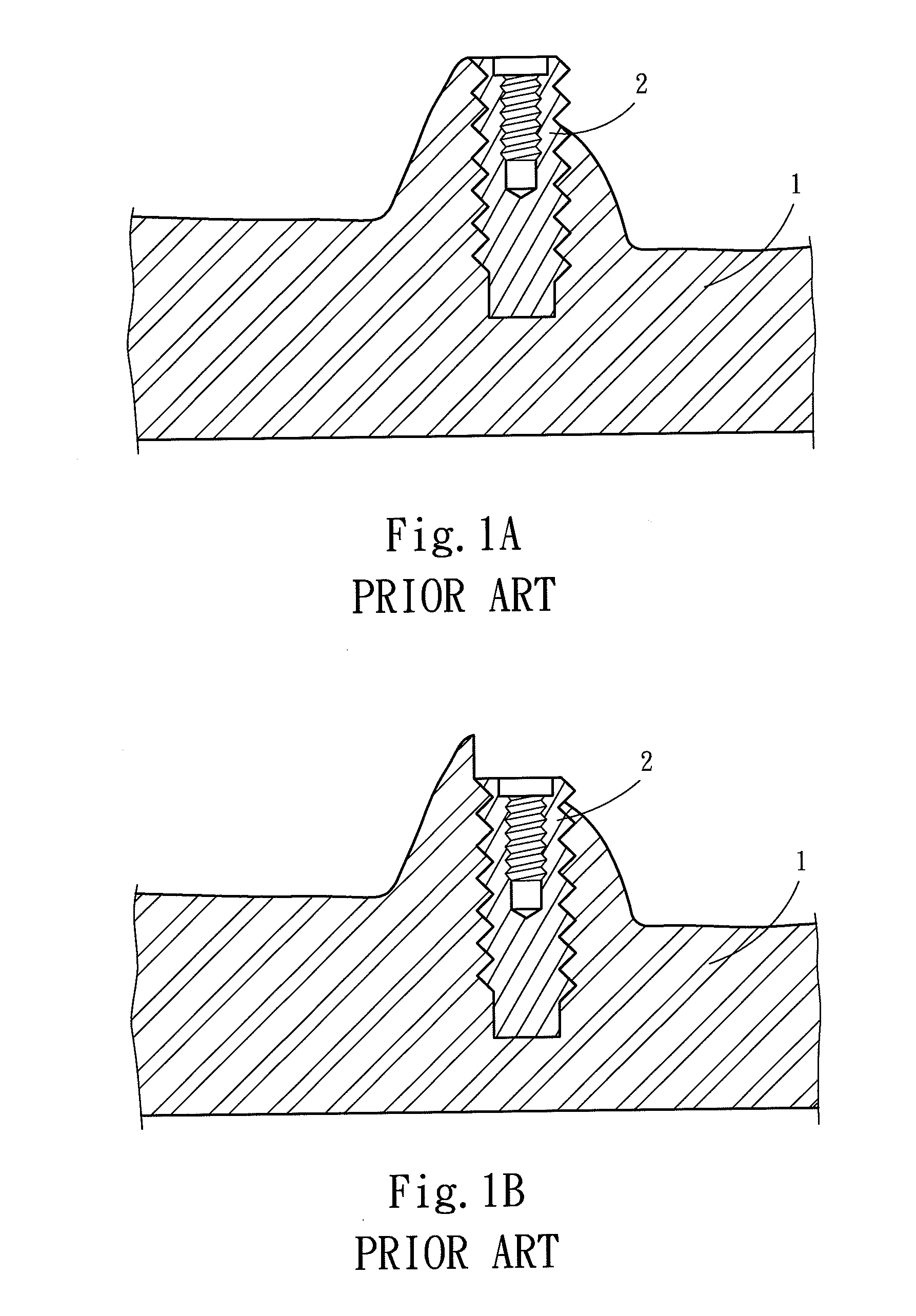 Universal dental implant structure