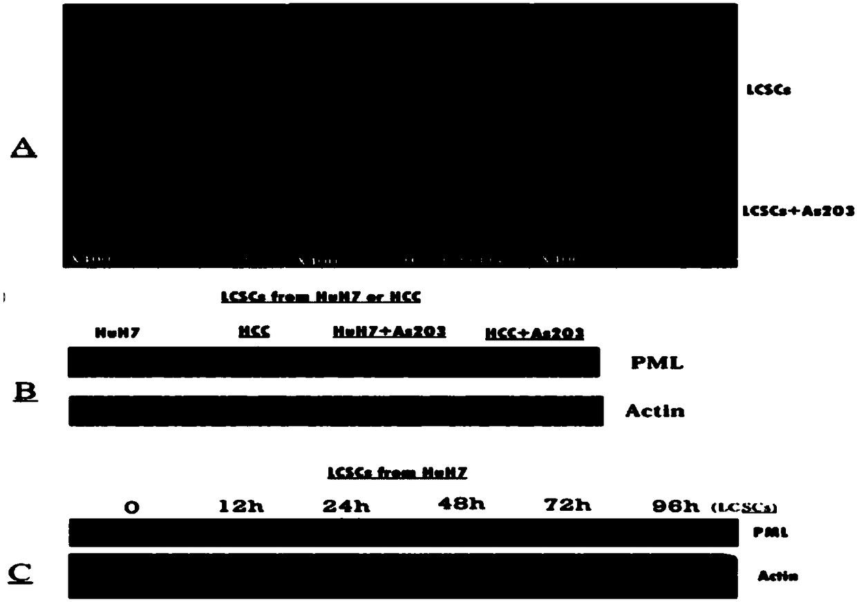 Pharmaceutical composition for removing residual liver cancer stem cells with combined use of arsenic trioxide and all-transretinoic acid and application thereof