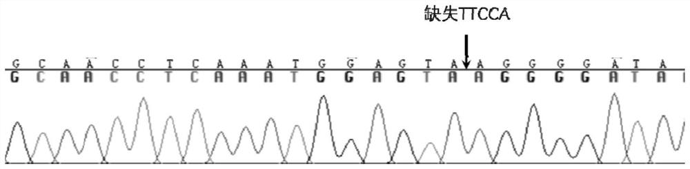 NtCHA1 gene capable of regulating and controlling potassium content of tobacco leaves and application of NtCHA1 gene