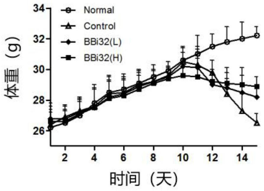 Bifidobacterium bifidum for relieving constipation and application thereof