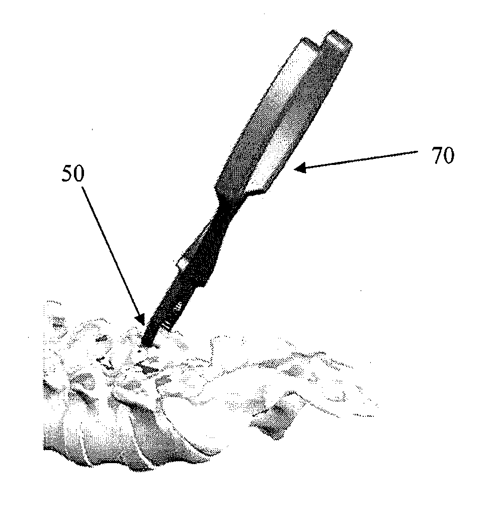 Spinous process spacer and implantation procedure