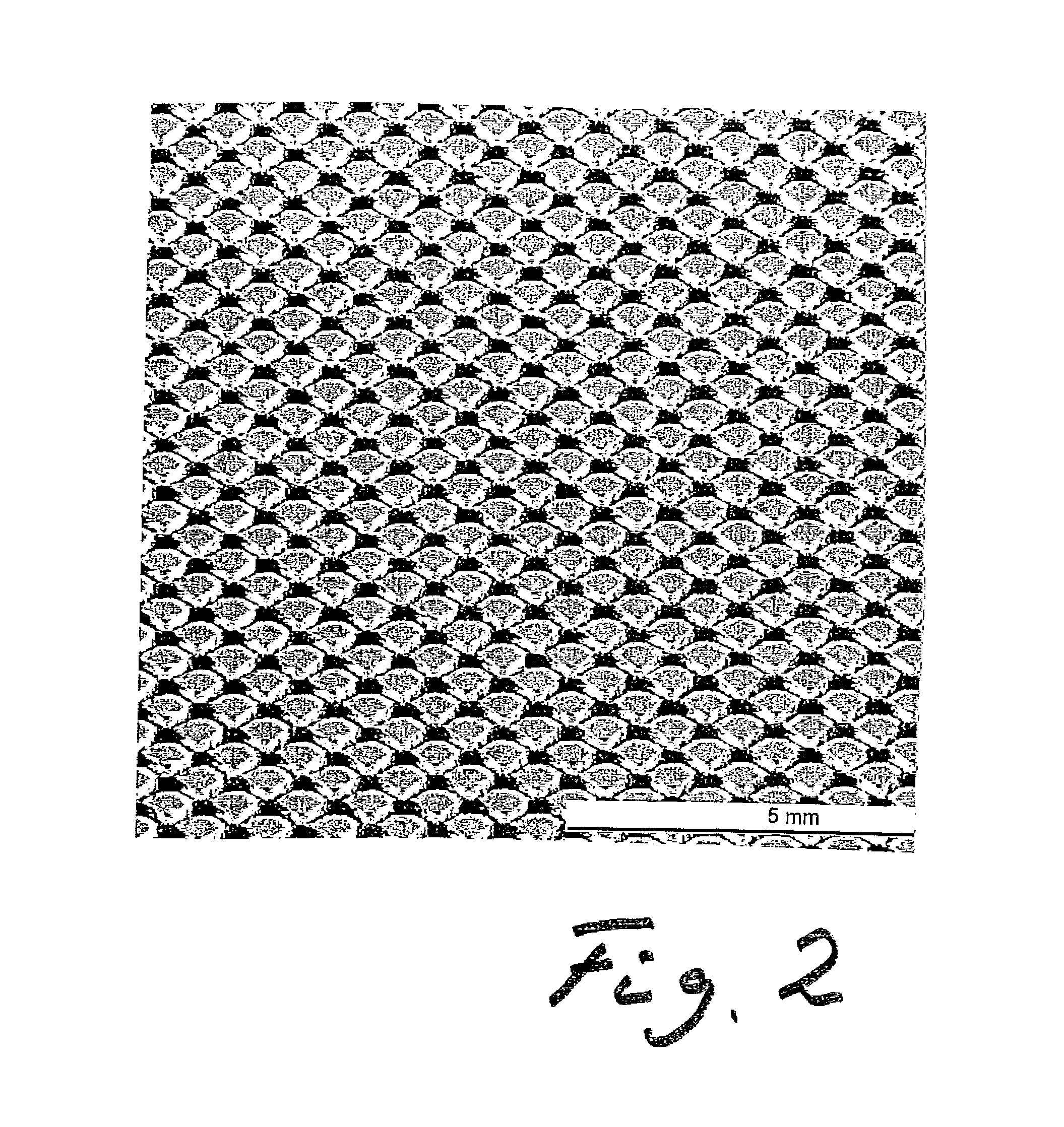 Contact element for an electrically conductive connection between an anode and an interconnector of a high-temperature fuel cell