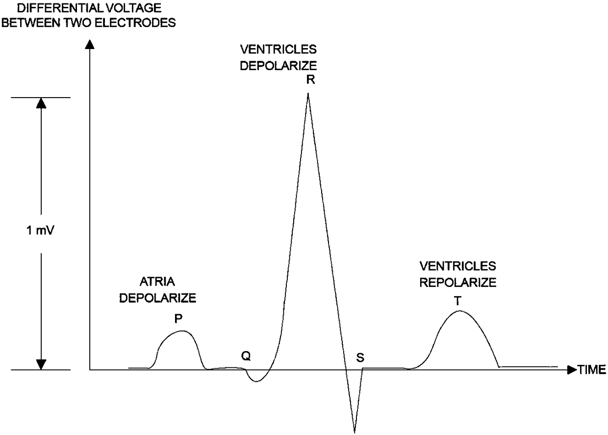 Dynamic heart rate detection method