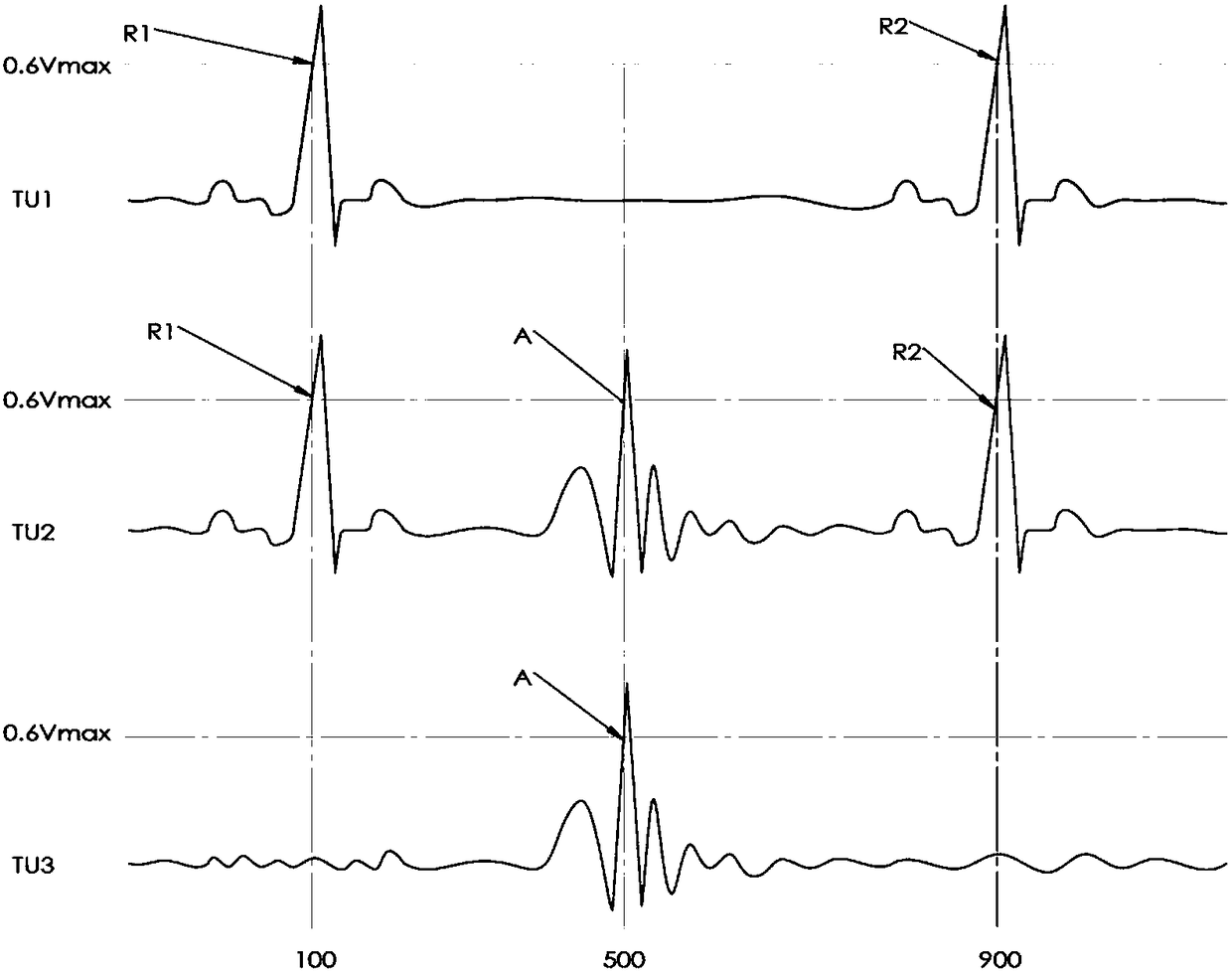 Dynamic heart rate detection method