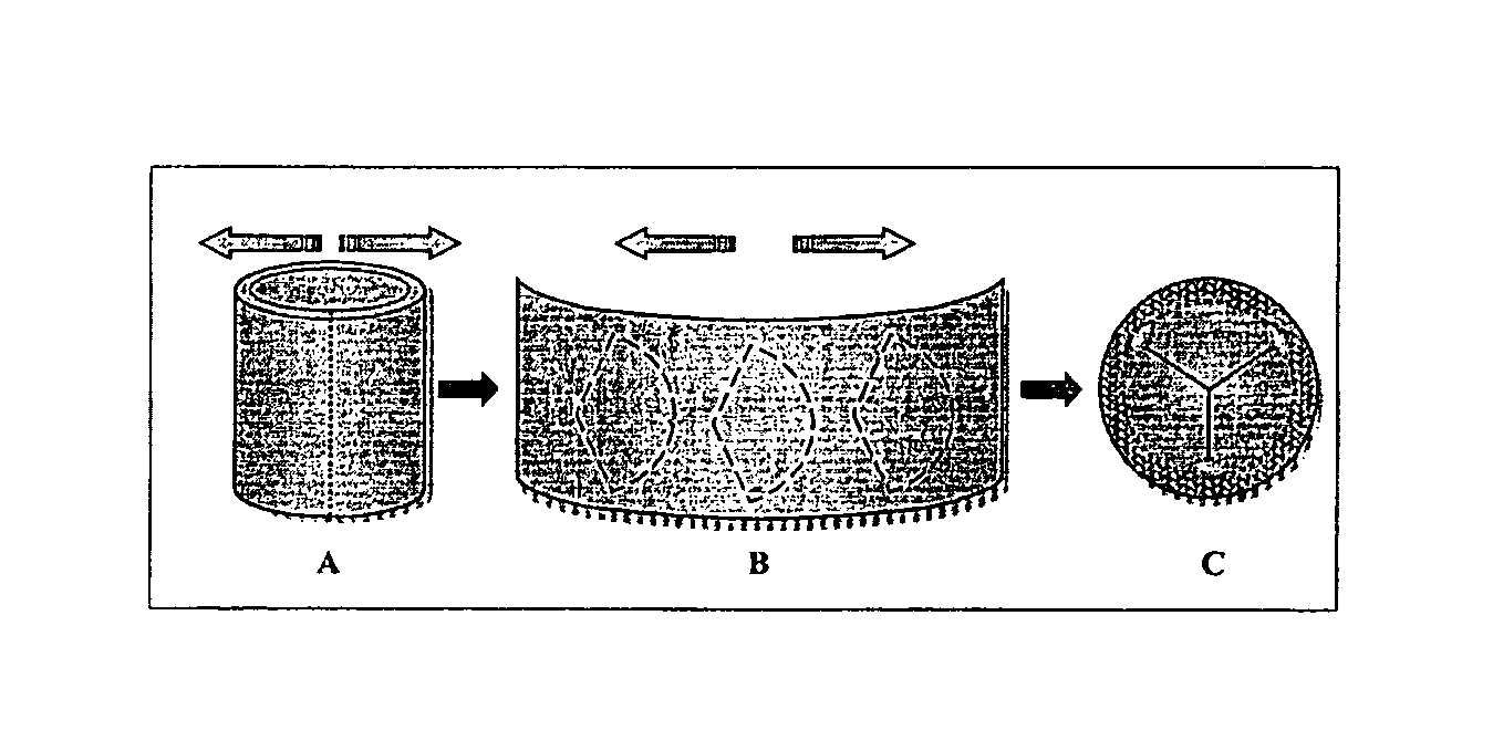 Tissue material process for forming bioprosthesis