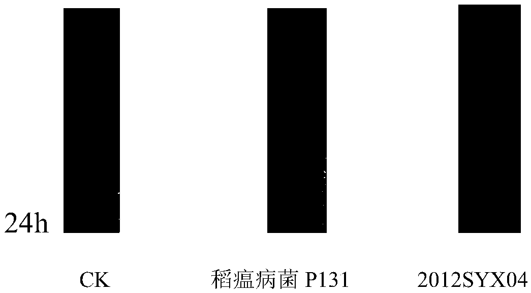 Bacillus subtilis 2012SYX04 for preventing and treating rice blast