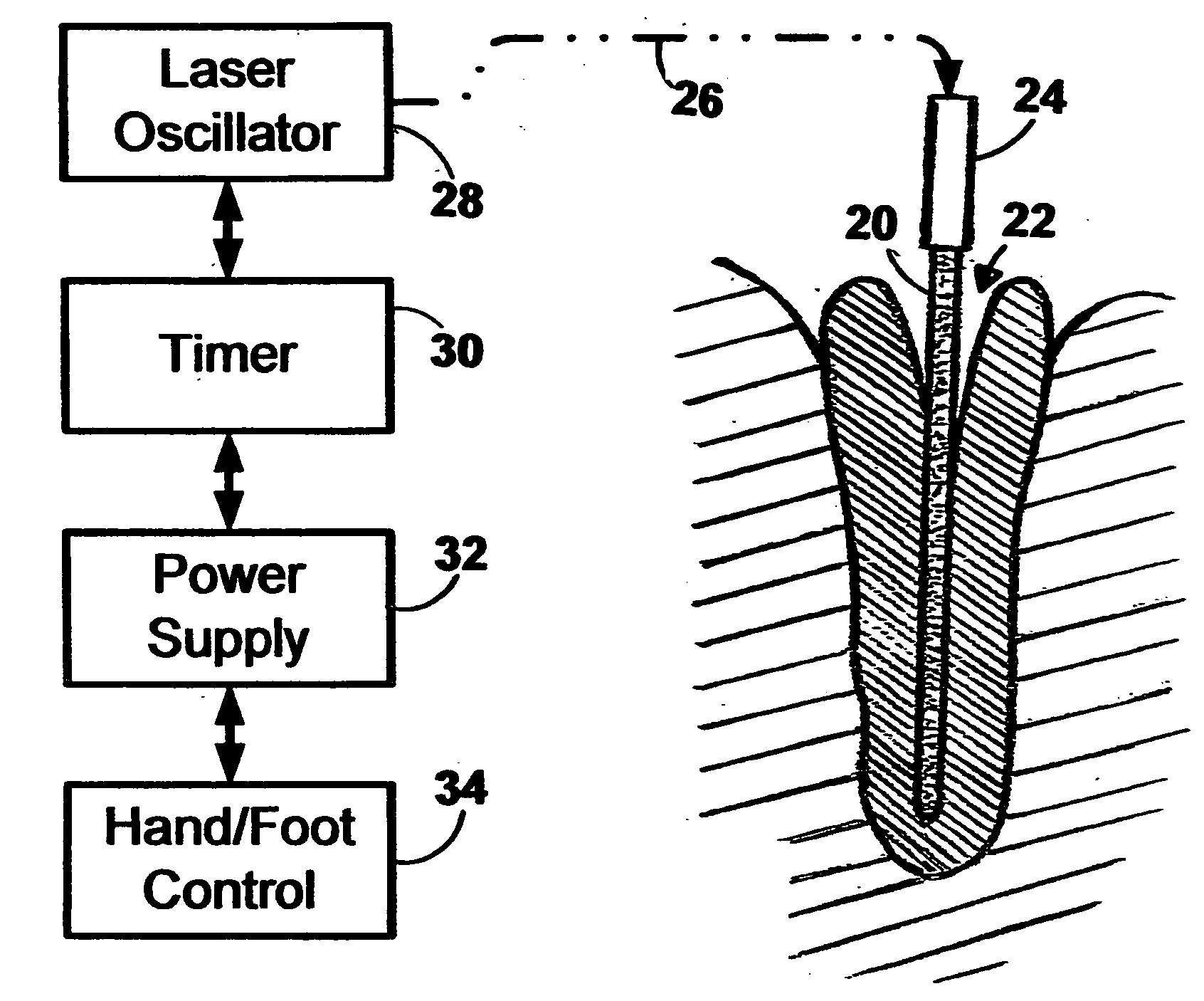 Instrument for delivery of optical energy to the dental root canal system for hidden bacterial and live biofilm thermolysis