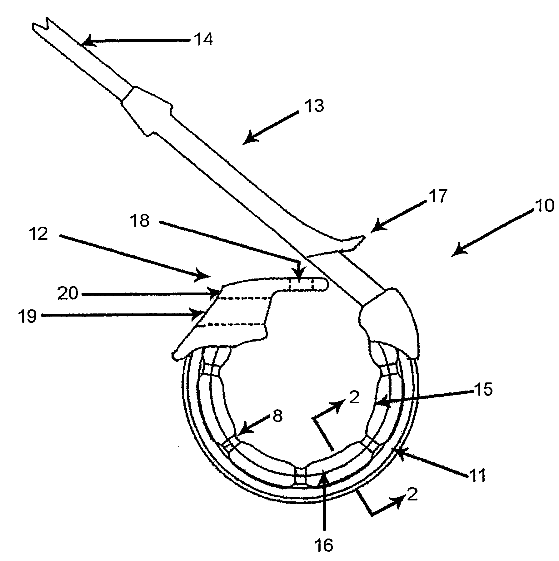 Fatigue-resistant gastric banding device