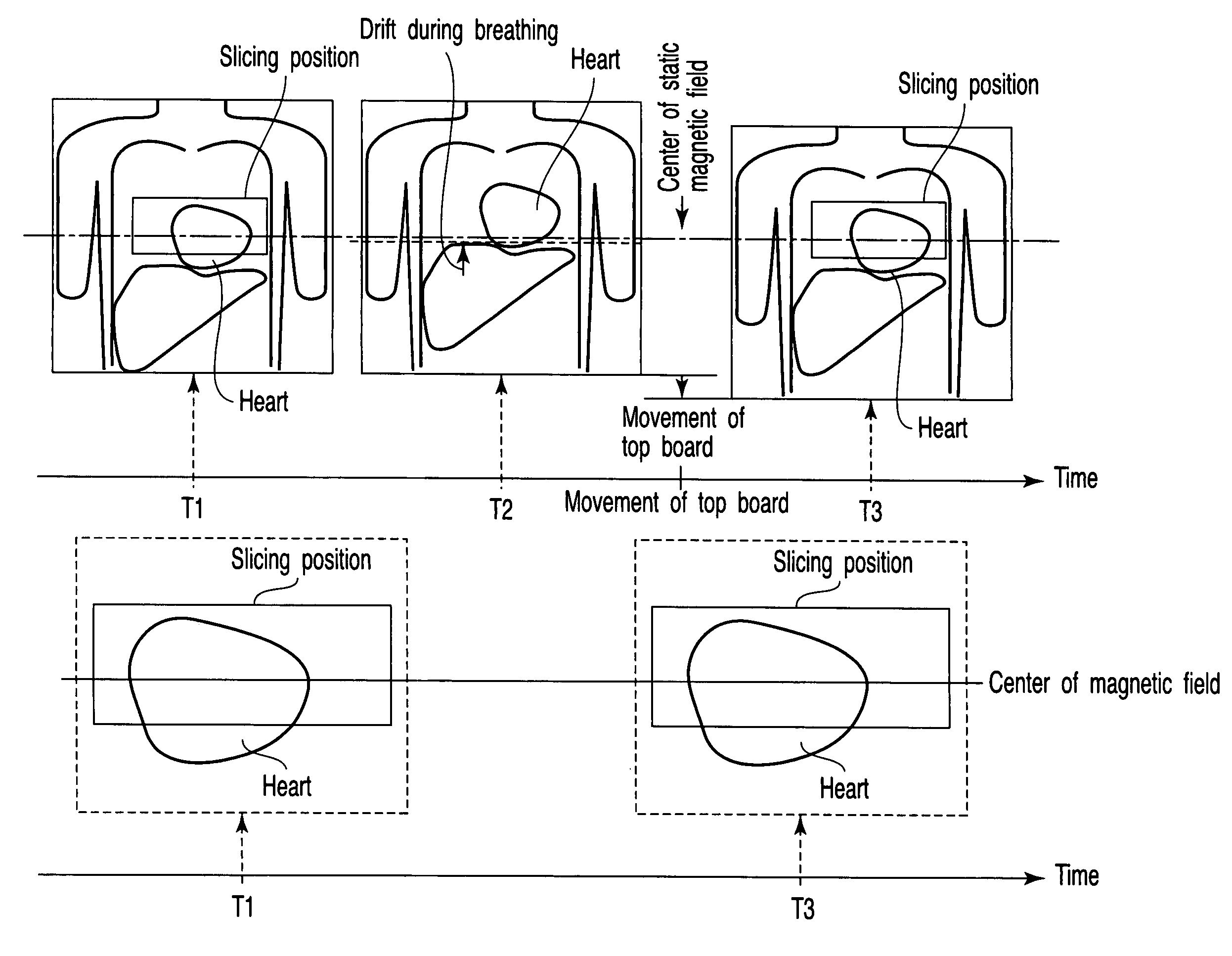 Magnetic resonance imaging apparatus and method