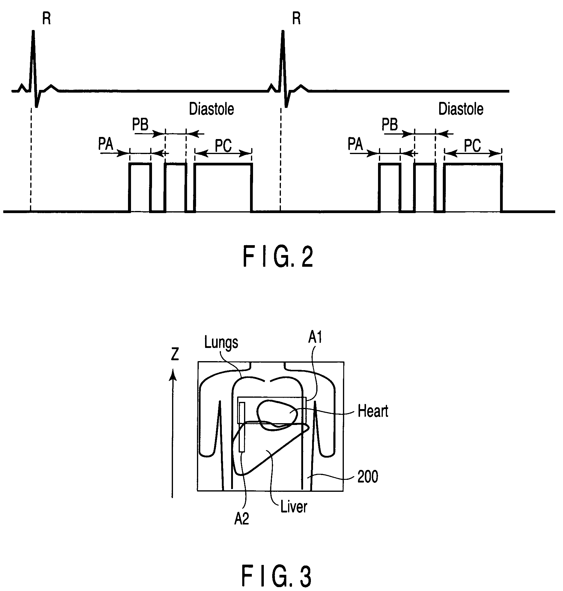 Magnetic resonance imaging apparatus and method