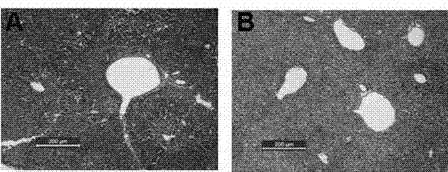 Application of dihydromyricetin in preparation of liver regeneration medicine