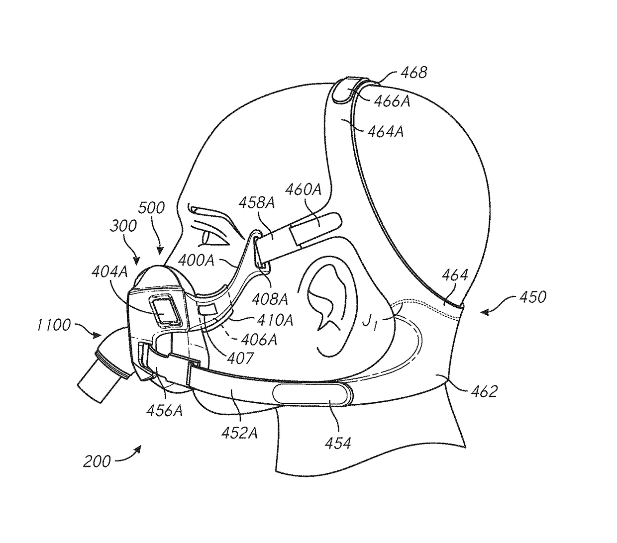 Patient interface