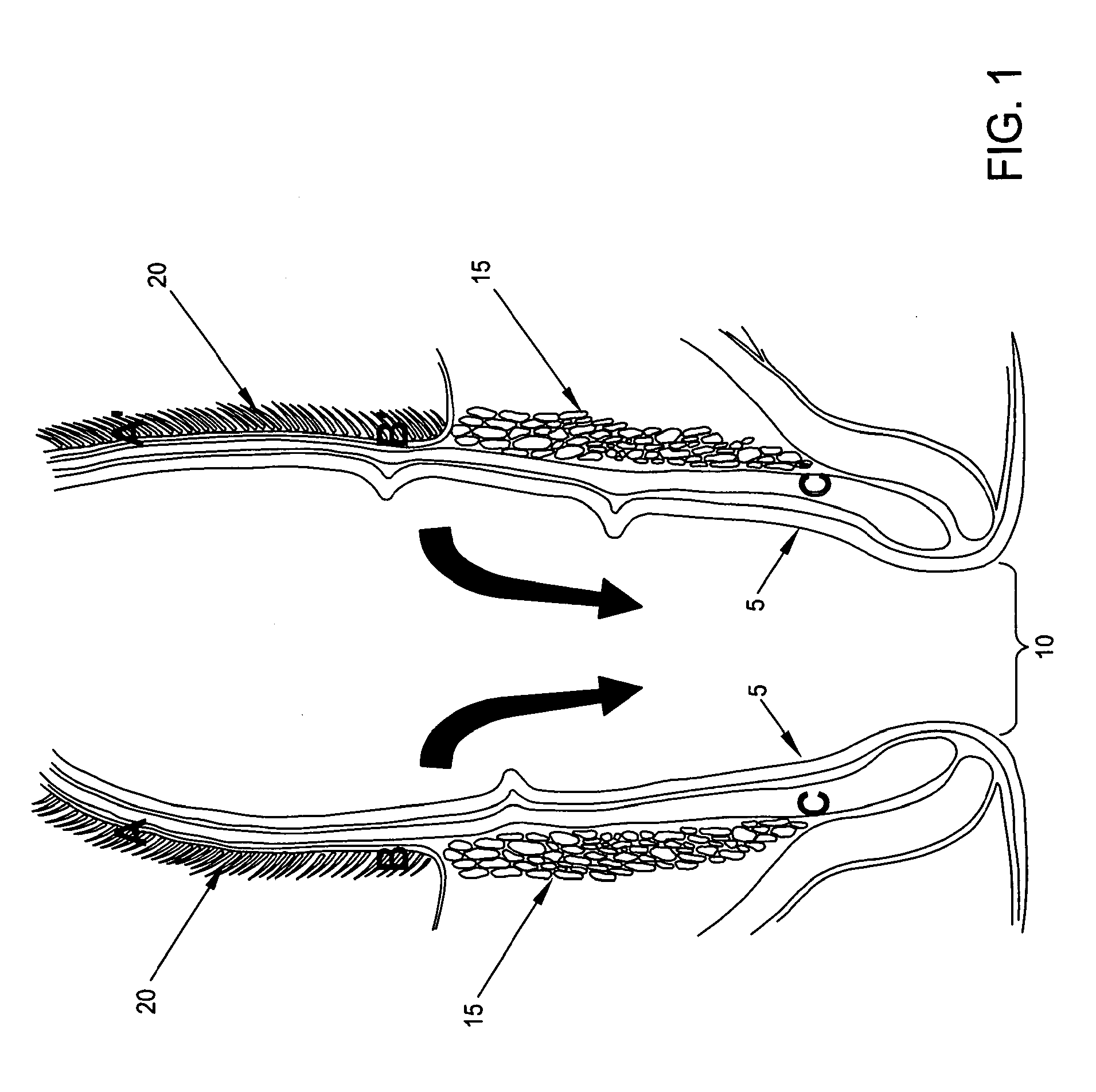 Method and apparatus for endoscopically treating rectal prolapse