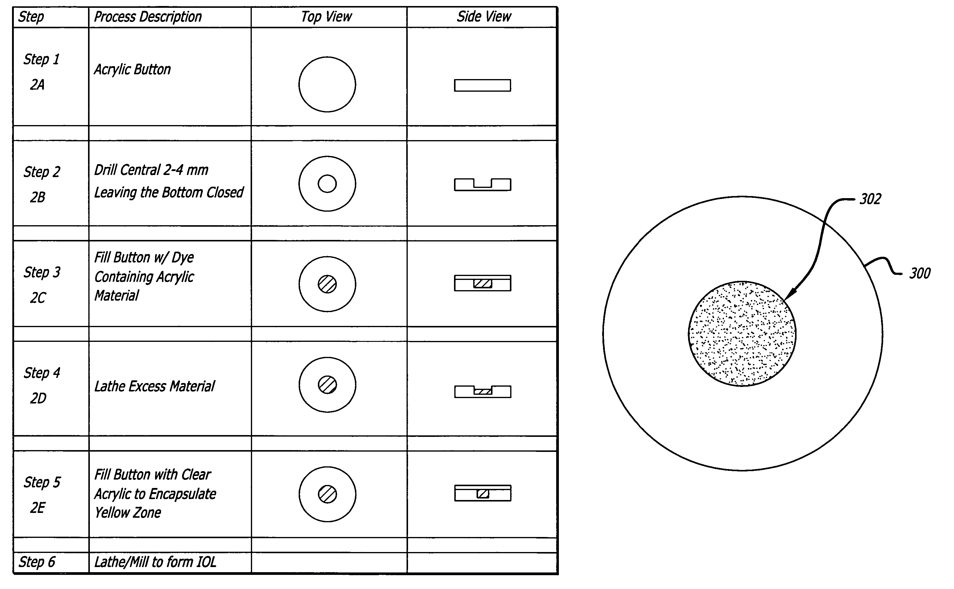 Intraocular lenses having a visible light-selective-transmissive-region