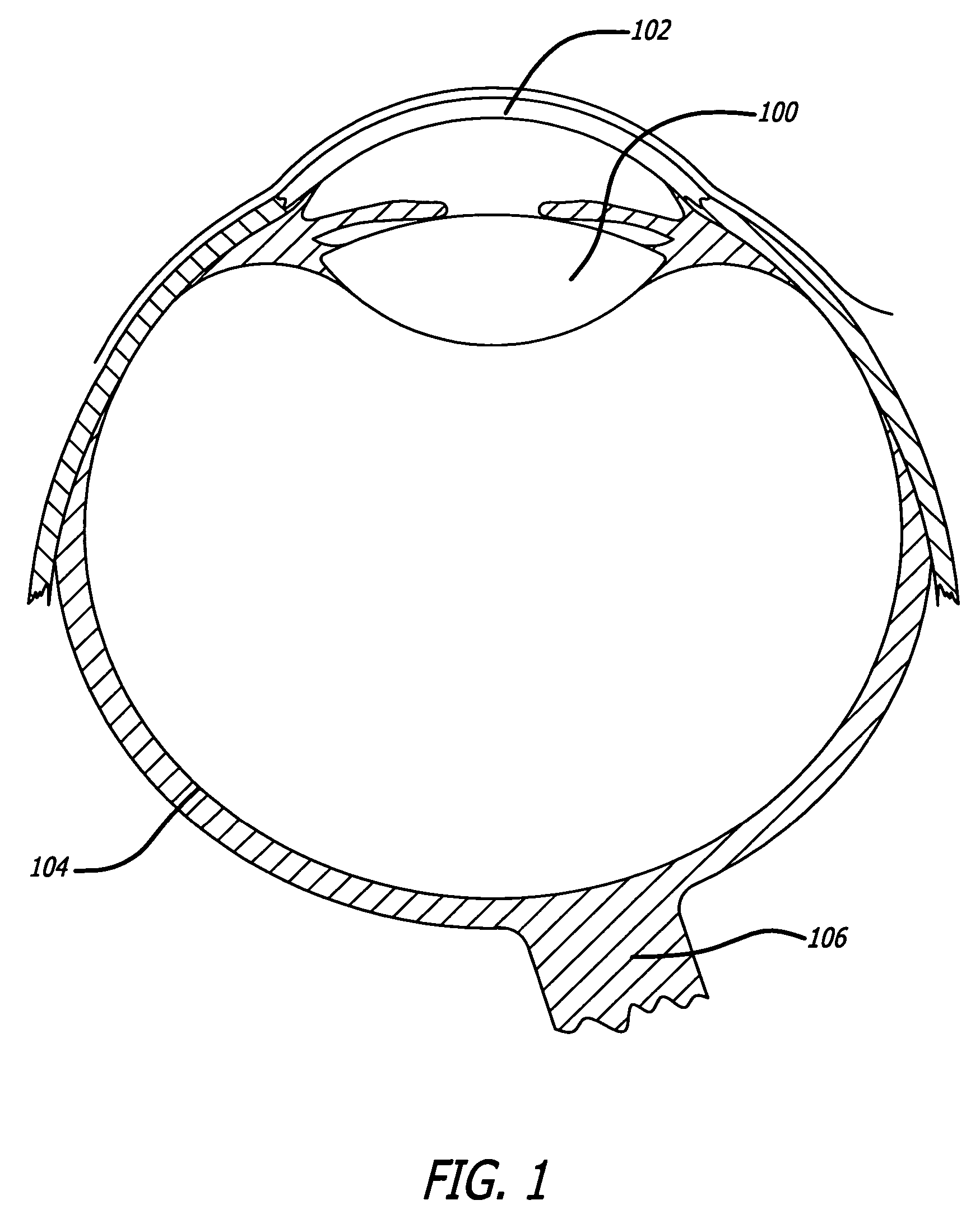 Intraocular lenses having a visible light-selective-transmissive-region