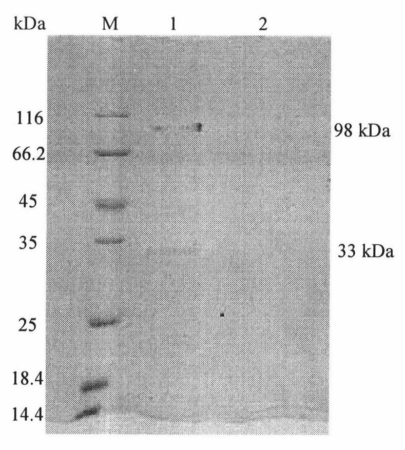 Clone and expression of alpha-glucosidase gene