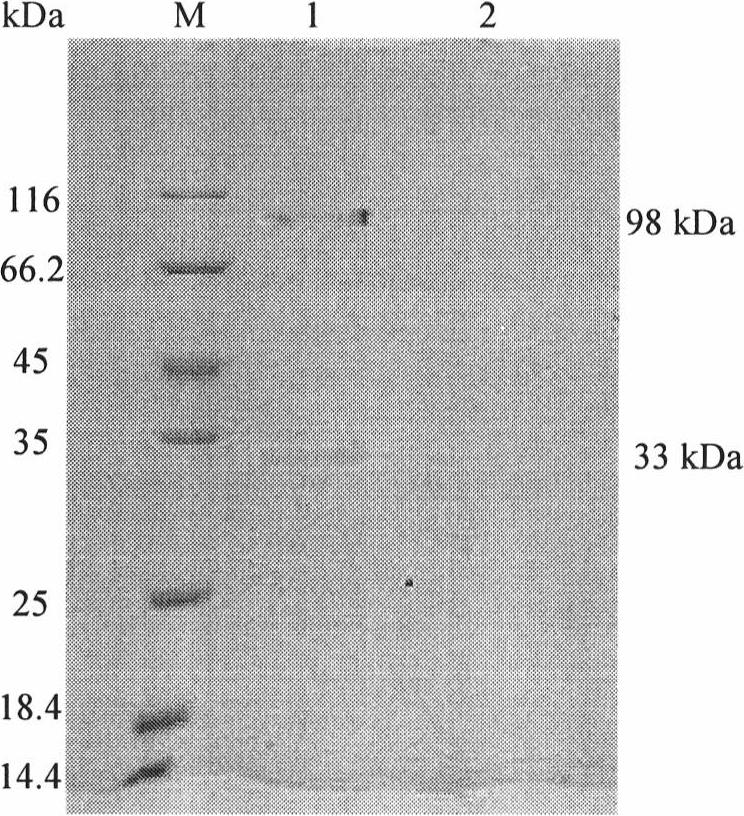 Clone and expression of alpha-glucosidase gene