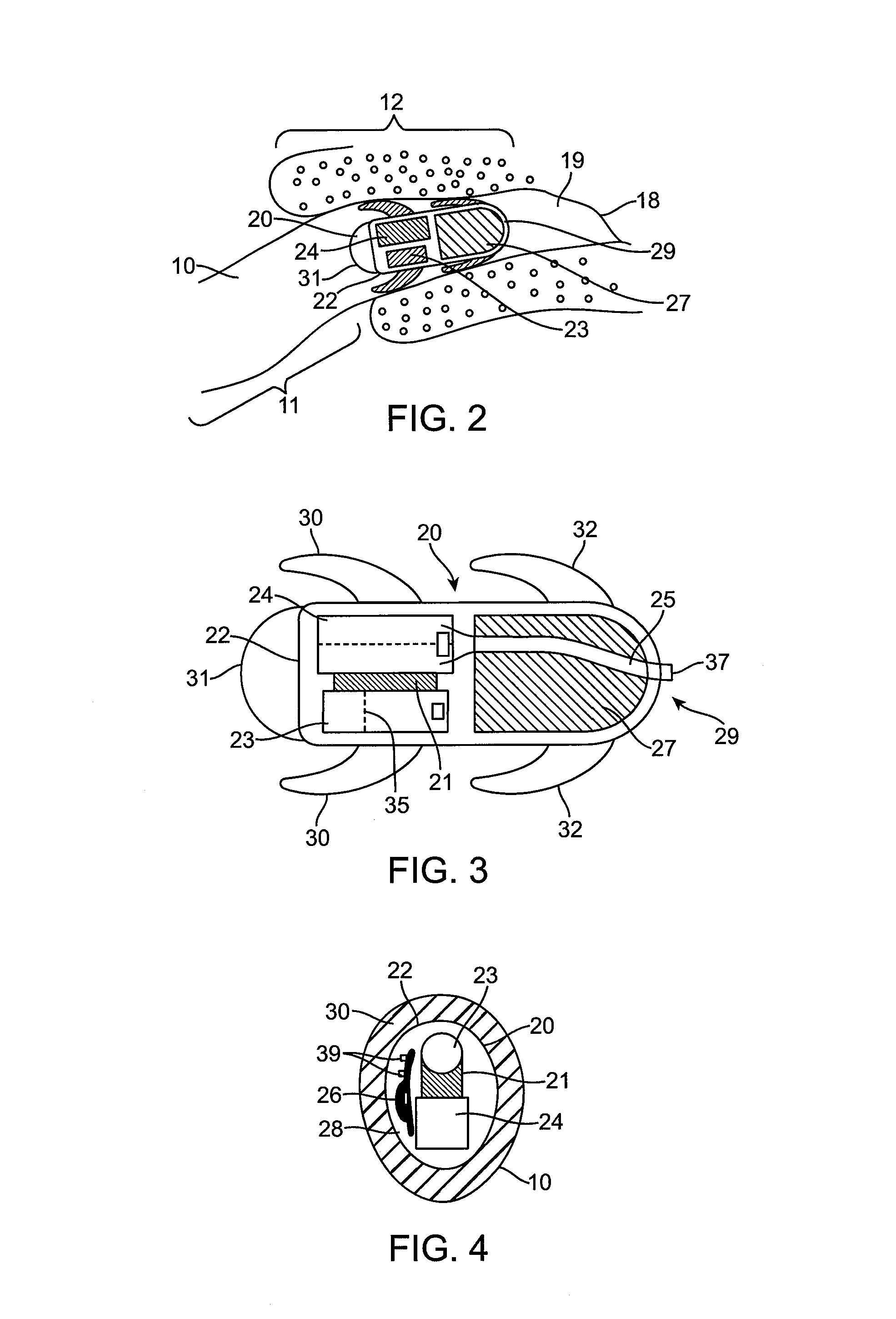 Combined microphone and receiver assembly for extended wear canal hearing devices