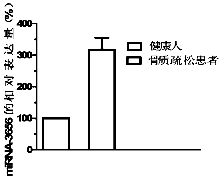 Diagnosis and treatment marker for postmenopausal osteoporosis