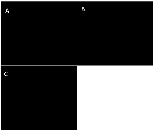 A culture method capable of improving the differentiation phenotype and function of hepatocytes in vitro