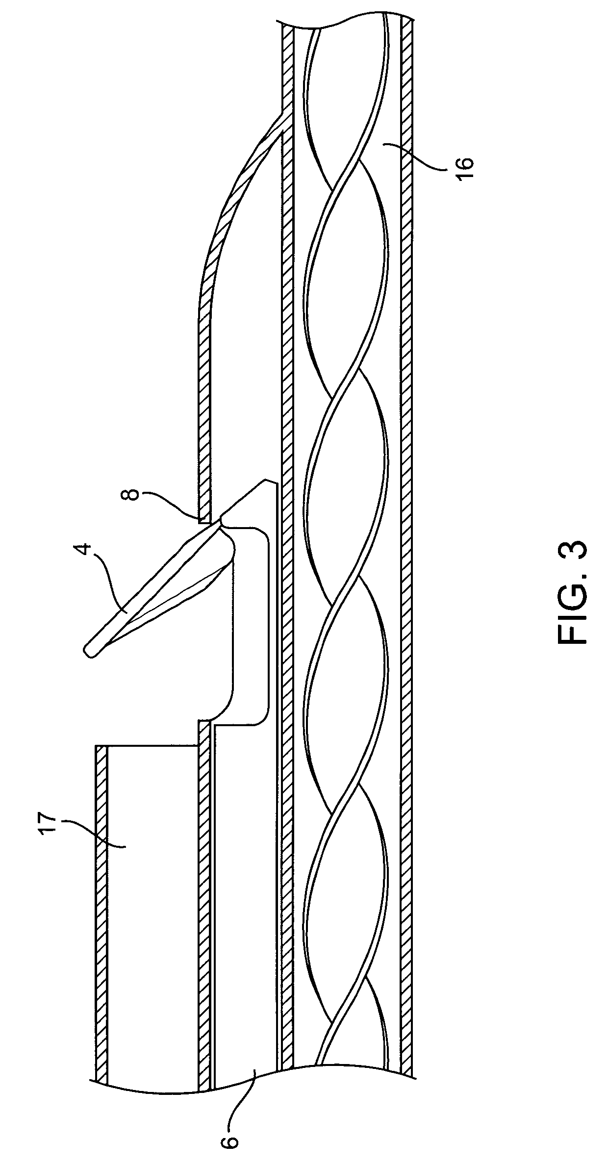 Methods and devices for improving the appearance of tissue