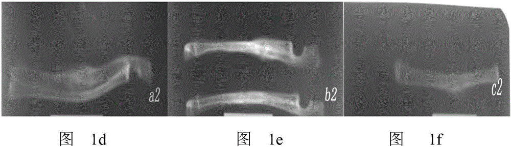 Stomach-harmonizing bone setting traditional Chinese medicine and preparation method thereof