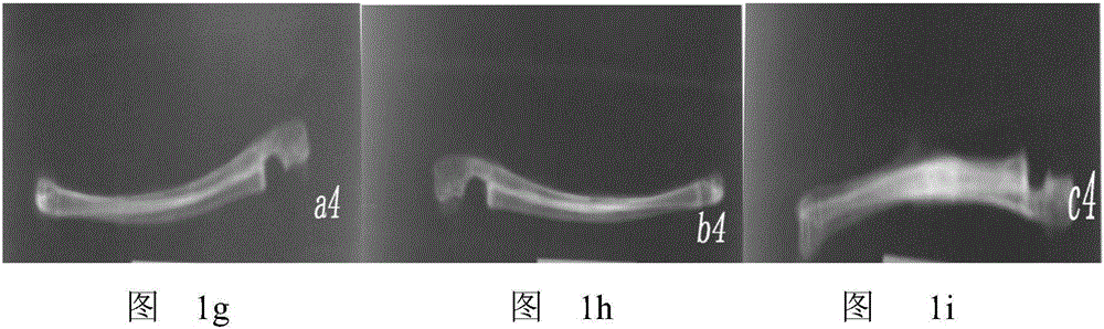 Stomach-harmonizing bone setting traditional Chinese medicine and preparation method thereof