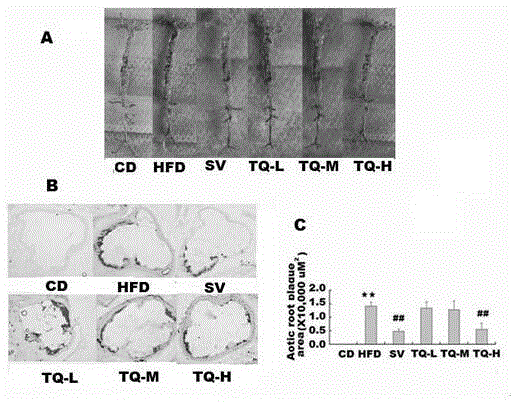 Application of alcohol extract of viburnum sargentii koehne to preparation of medicines for treating atherosclerosis diseases