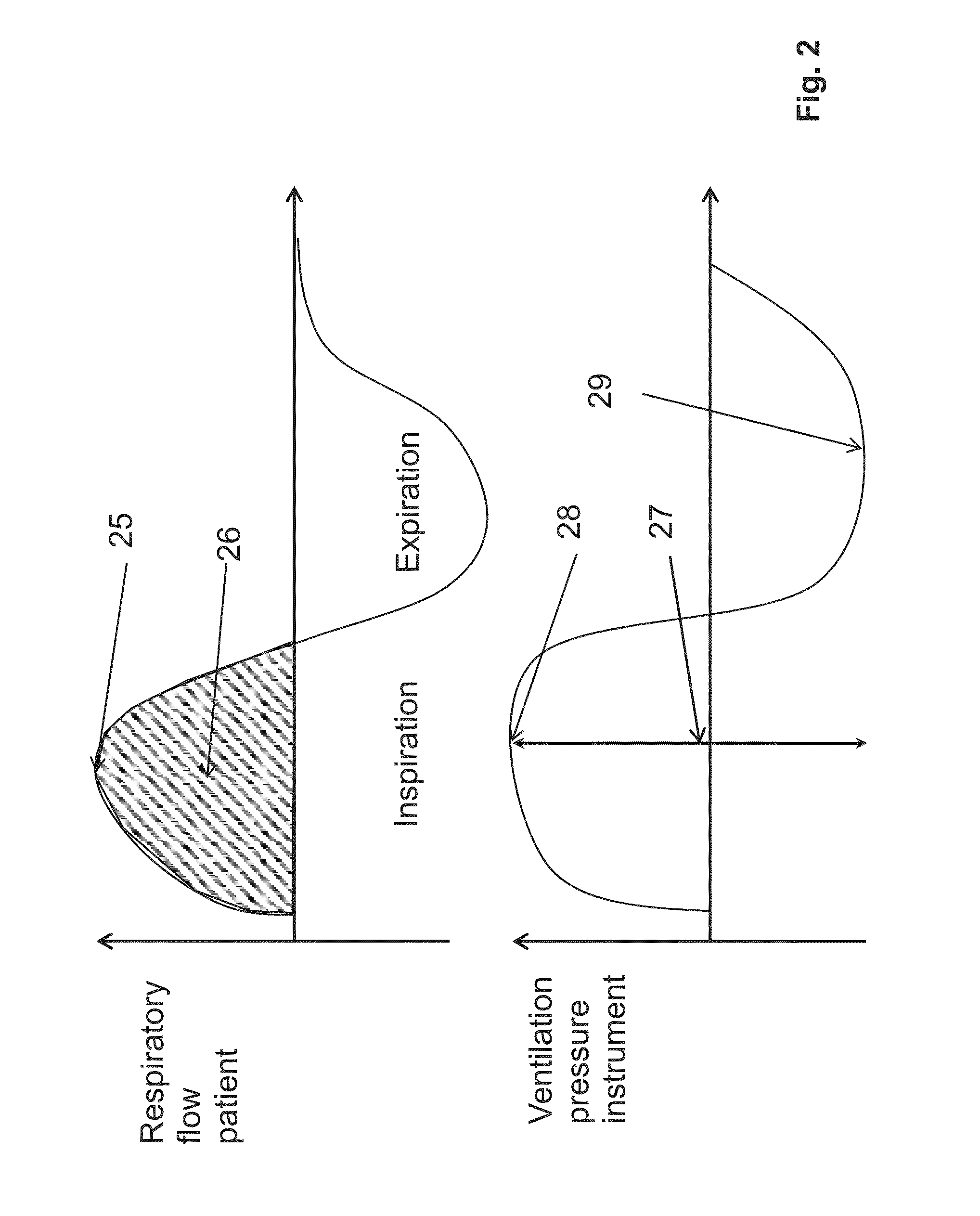 Method and device for therapy of periodic respiration