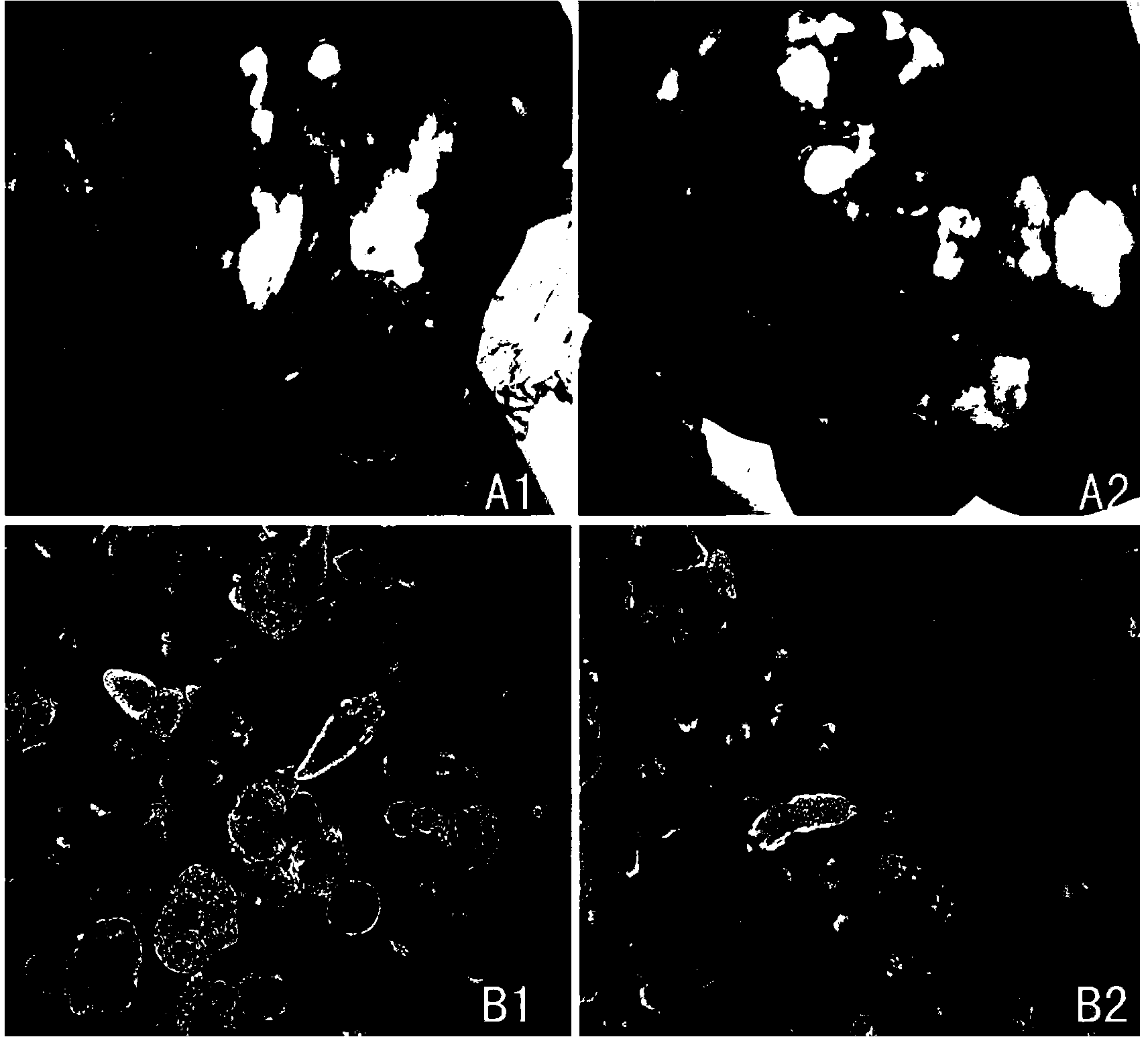 Interfering RNA for inhibiting and treating echinococcus granulosus disease and application thereof