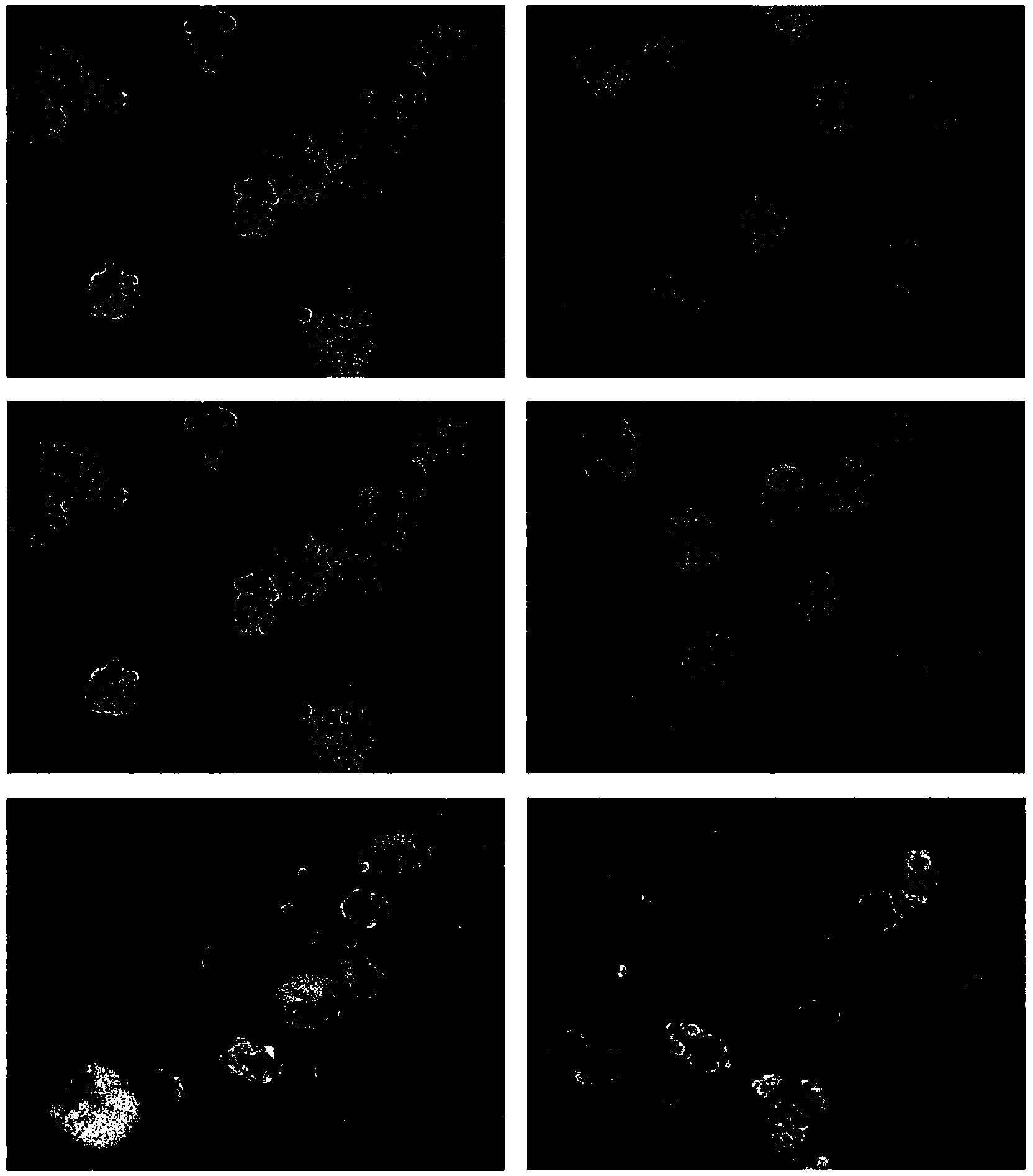 Interfering RNA for inhibiting and treating echinococcus granulosus disease and application thereof