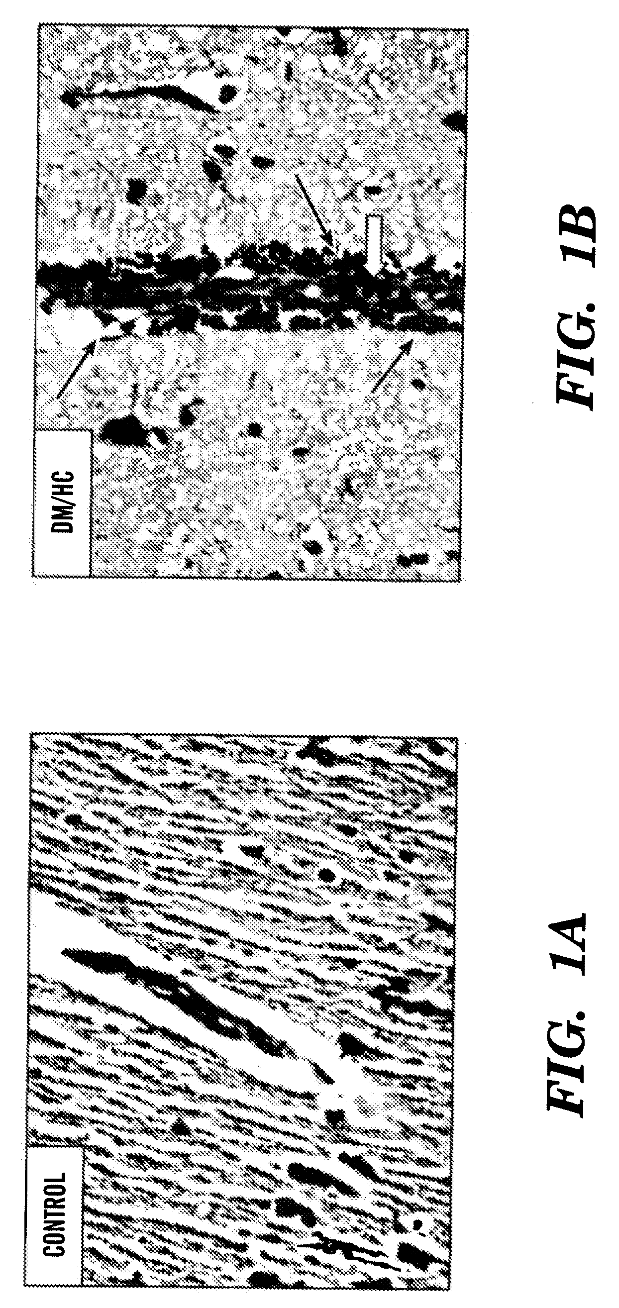 Methods of treatment and prevention of neurodegenerative diseases and disorders