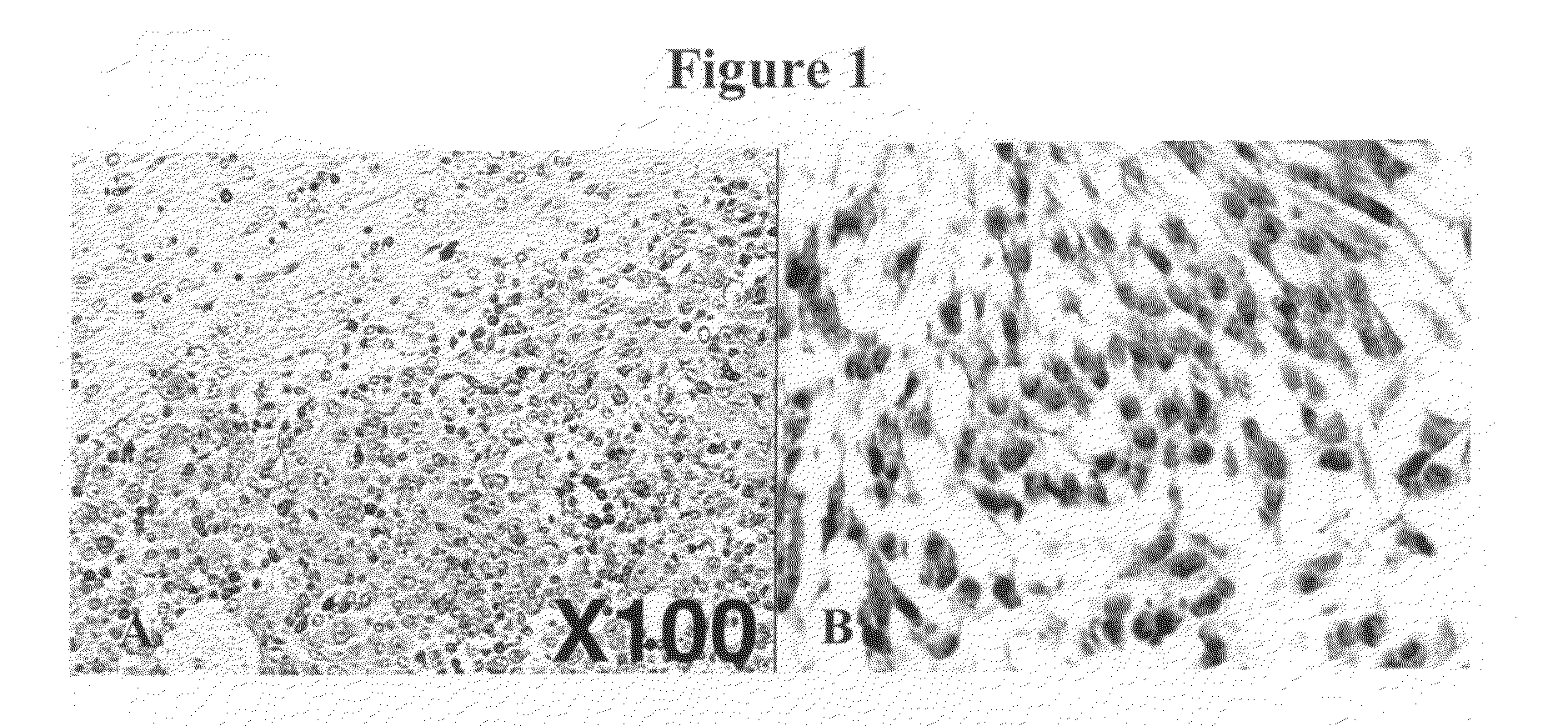 Synthetic LDL as Targeted Drug Delivery Vehicle