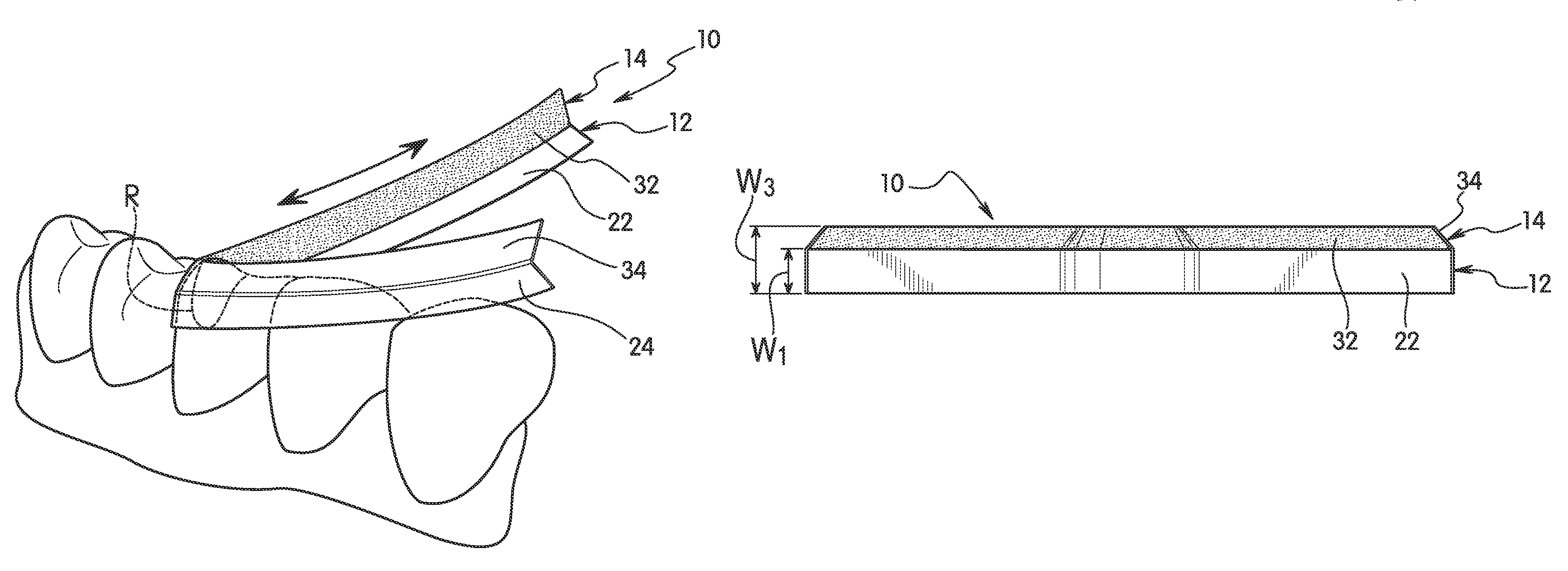 Dental shaping strip