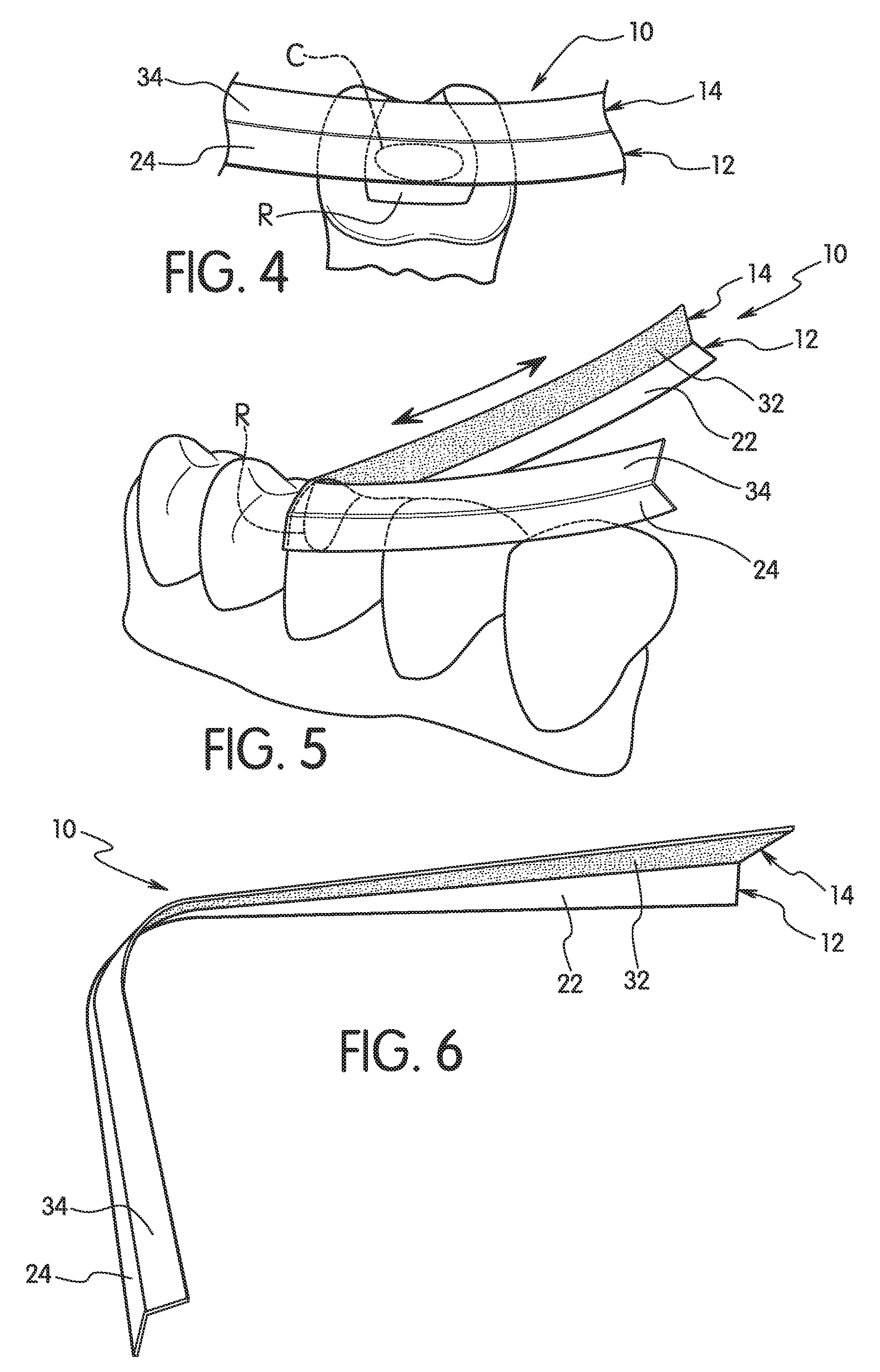 Dental shaping strip