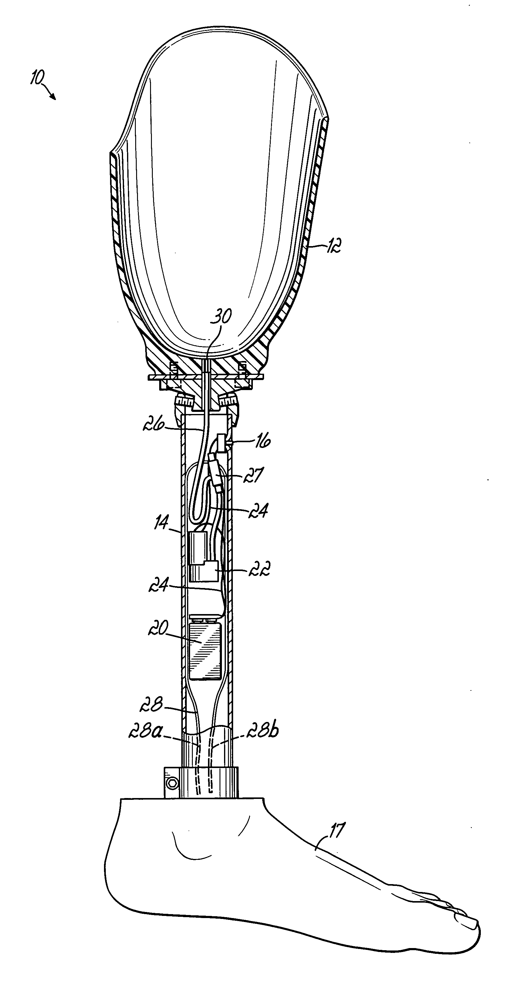 Prosthetic device utilizing electric vacuum pump