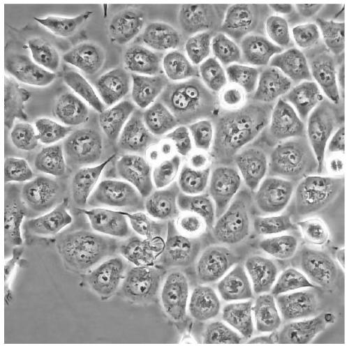 Construction method for nasopharynx cancer clinic related radioresistance cell strain