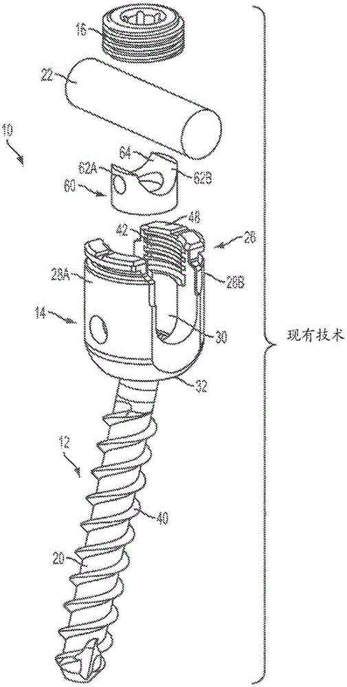 Bone anchors and surgical instruments with integrated guide tips