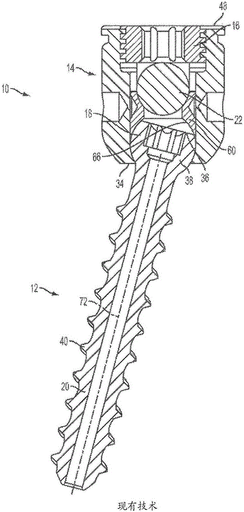 Bone anchors and surgical instruments with integrated guide tips