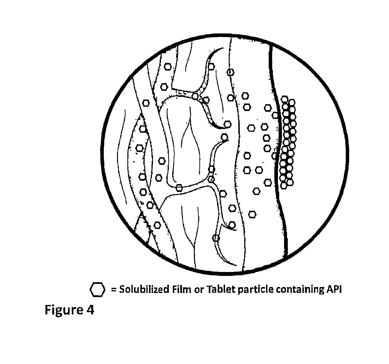 Method of treatment and device for the improved bioavailability of leukotriene receptor antagonists