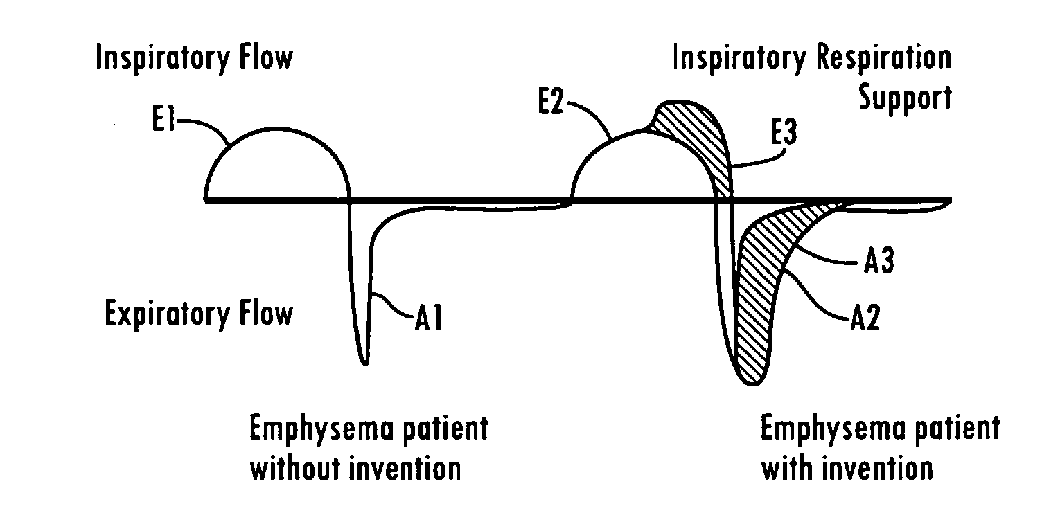 Tracheal catheter and prosthesis and method of respiratory support of a patient