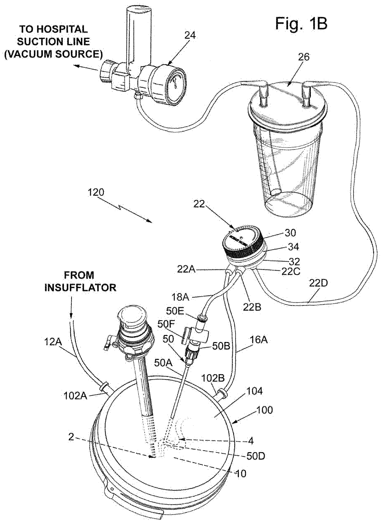 System and regulator device for evacuating smoke from a laparoscopic field and method of evacuating smoke from a laparoscopic field