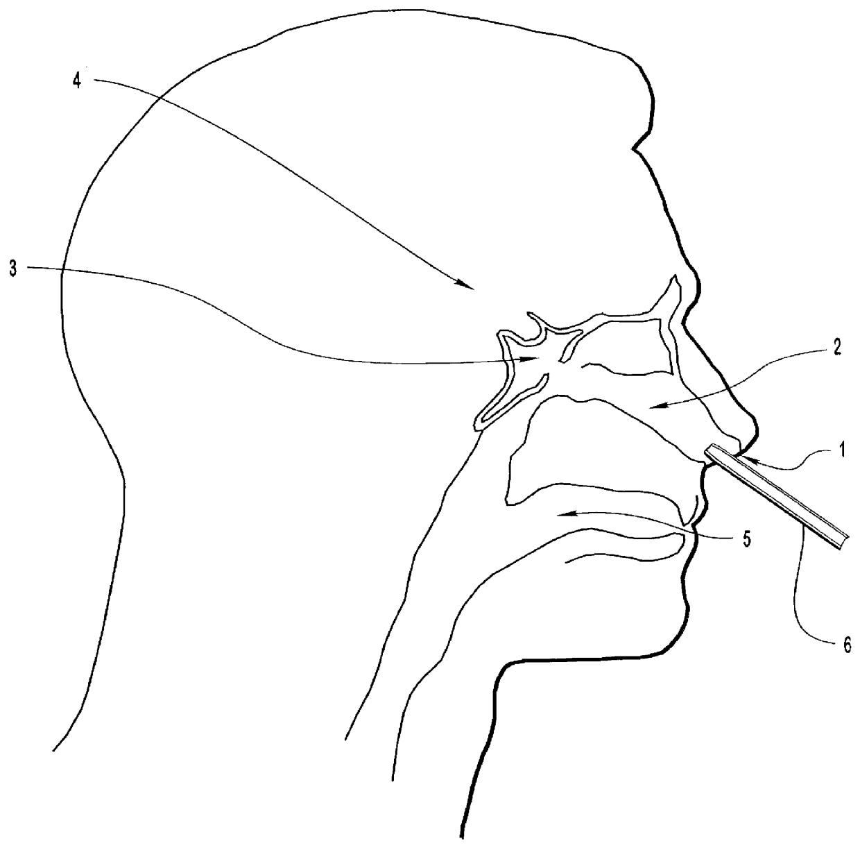 Method for inducing hypothermia